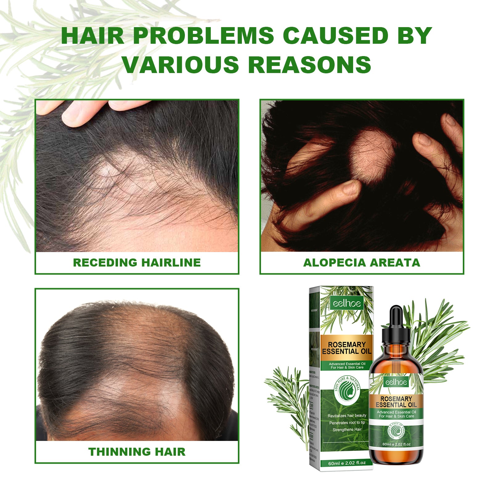 Rosemary Essential Oil Hydrates And Moisturizes Damaged Hair, Strengthens Hair And Softens Hair Care Essential Oil