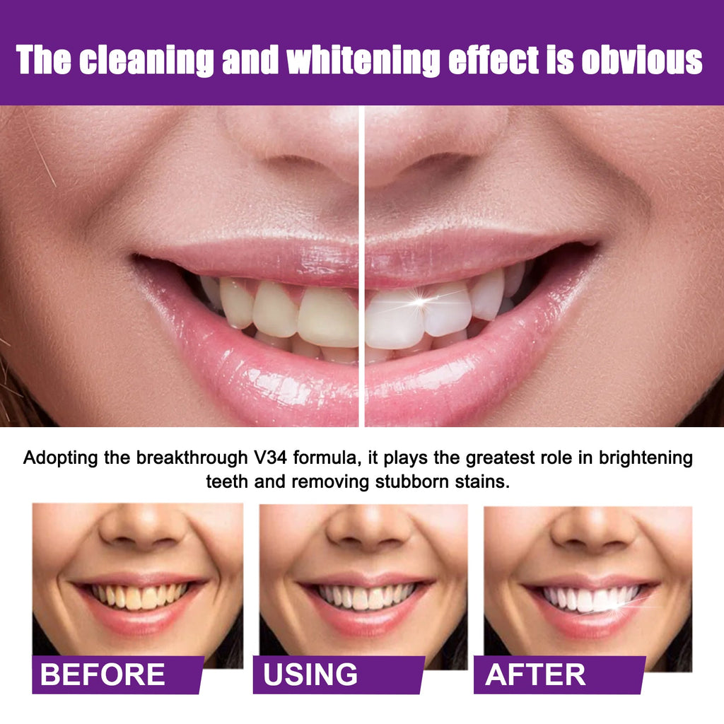 Color Correcting Technology, Clean Stains And Oral Odor Care For Gums Whitening Tooth Toothpaste